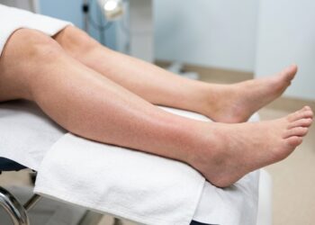 Trombose e dor muscular na perna: como diferenciar antes que seja tarde