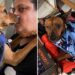 Cão caolho rejeitado em abrigo emociona ao provar que amor não depende da aparência