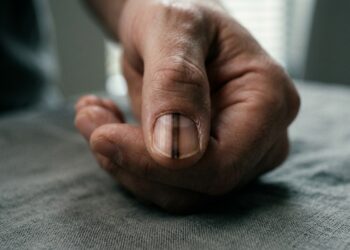 Os sinais de alerta nas unhas que exigem um dermatologista em até 2 semanas