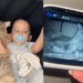Gata internada se acalma com blusa de bebê e revela o poder do vínculo emocional entre espécies
