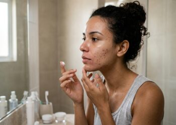 Mulher com pele oleosa e acne aplica hidratante enquanto apresenta pequenas áreas de ressecamento no rosto.