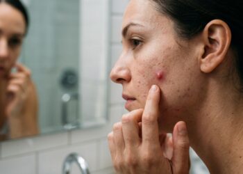 Mulher observa uma espinha inflamada no rosto enquanto aproxima os dedos da lesão sem apertá-la.
