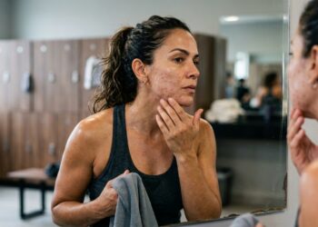 Mulher observa pequenas áreas avermelhadas no rosto após exercício e contato repetido da pele com tecidos.