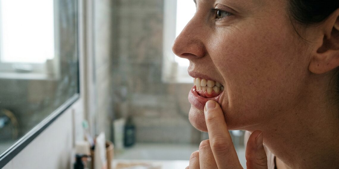 Pessoa observa a gengiva no espelho ao perceber sinais de inflamação.