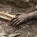 Prótese histórica de ferro encontrada na Baviera