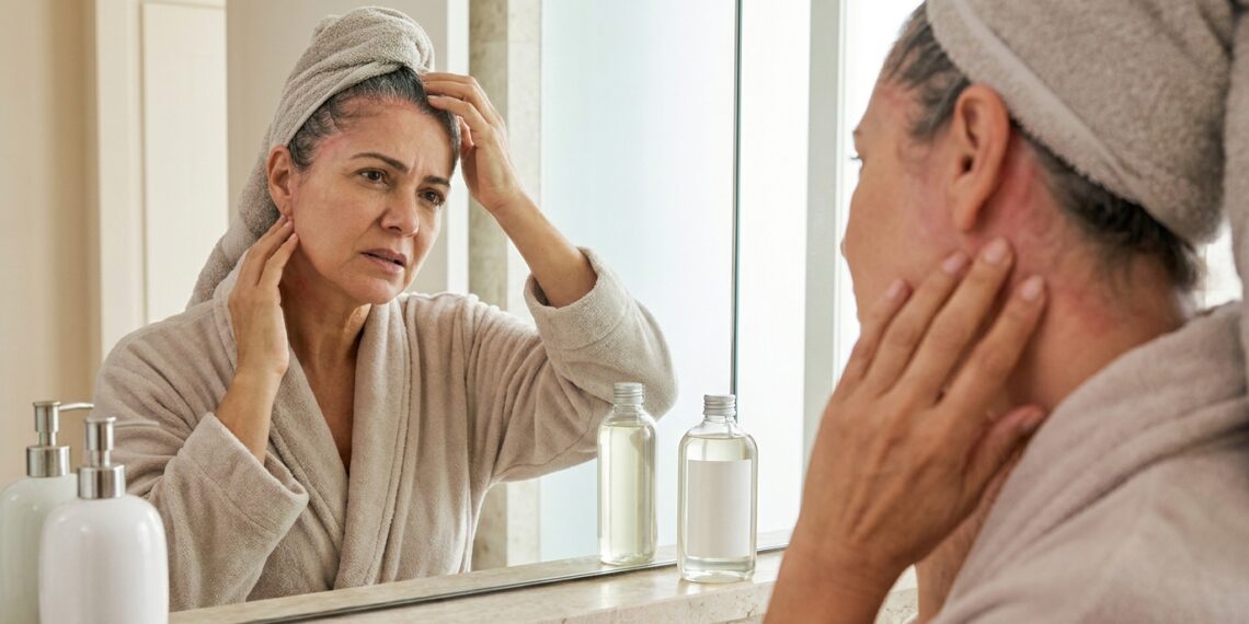 Mulher toca o couro cabeludo avermelhado depois de usar shampoo.