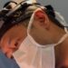 Cirurgia plástica pós-gestação: o corpo muda e o planejamento é além da estética
